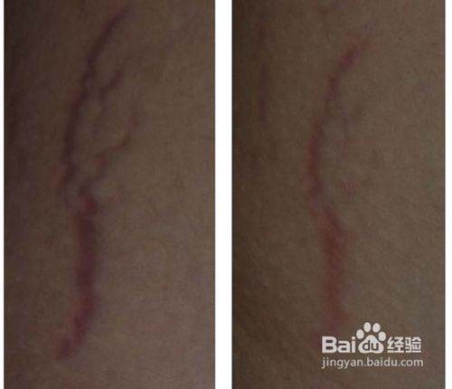 掩役夫张进骸-hth·华体(图4) hth·华体