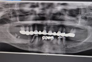 “hth·华体”4G冲击波比想象中来得更猛一些(图3) hth·华体
